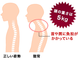 猫背で首が前に出ると負担が何倍にも!